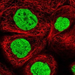 ALPK3 Antibody, Novus Biologicals:Antibodies:Primary Antibodies